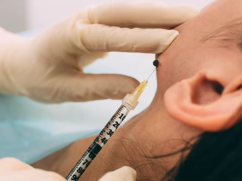 Professional Occipital Nerve Block Treatment services by Premier Injury Specialists in Forest Park, GA — licensed Injury Specialists provider