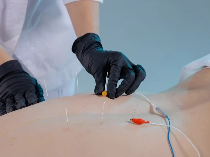 Professional service work by Premier Injury Specialists in Forest Park